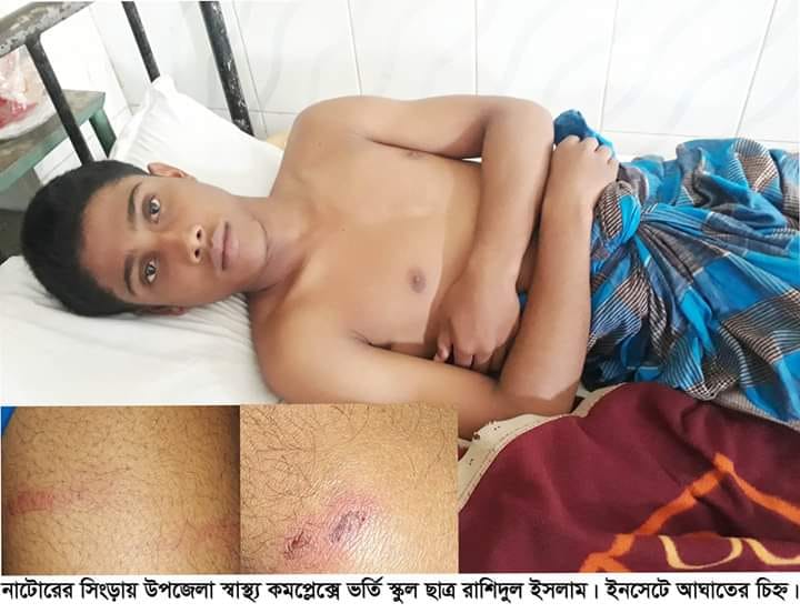 নাটোরে টিসি চাওয়ায় ছাত্রকে পেটালেন প্রধান শিক্ষক